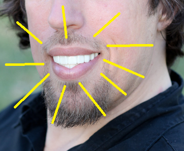CHOMPERS